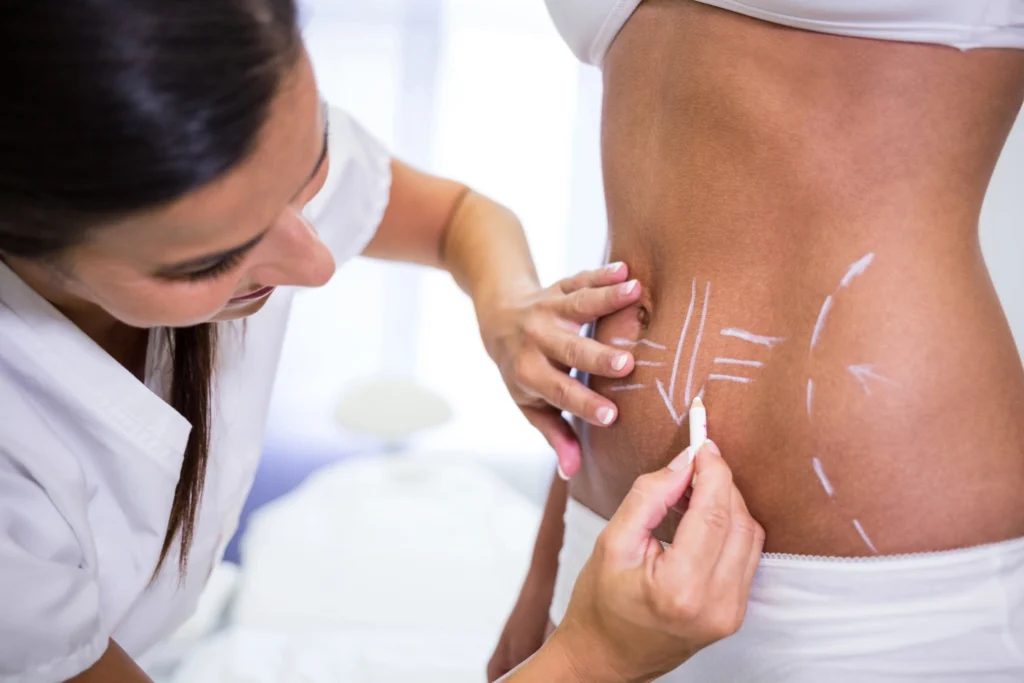 MESTRADO EM CIRURGIA DE CONTORNO CORPORAL: LIPOASPIRAÇÃO, LIPO HD E LIPOESCULTURA 3