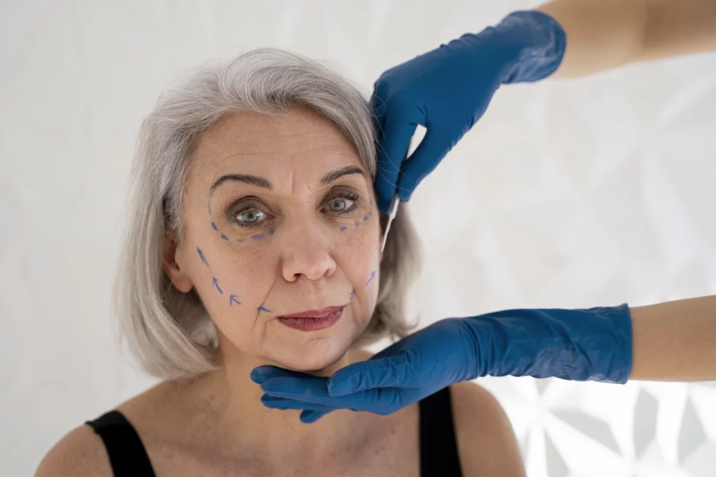 Mestrado em Rejuvenescimento Facial Cirúrgico: Lifting Facial e do Pescoço da ISEIE Brasil 2