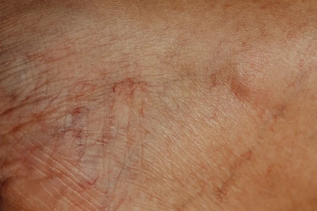 Mestrado em Oncologia Cutânea Básica para Clínicas Estéticas — Detecção e Encaminhamento 3