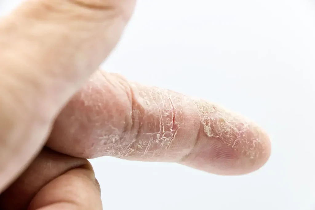 Mestrado em Medicina Estética em Peles com Doença Dermatológica e Segurança 2