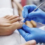 Diplomado en podología estética