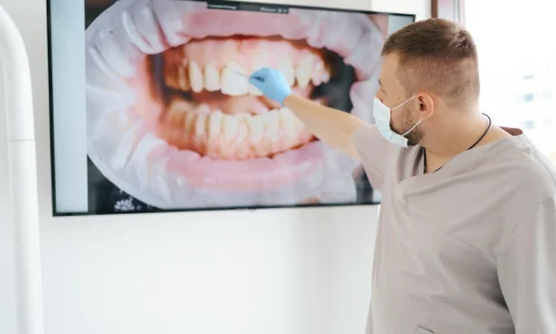 Diplomado en Fotografía Odontológica
