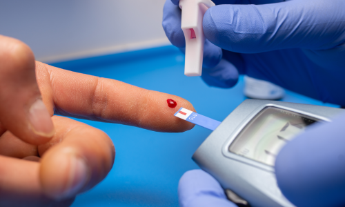 Mestrado Integral en Pé de Risco: Diabetes, Vascular e Feridas 1