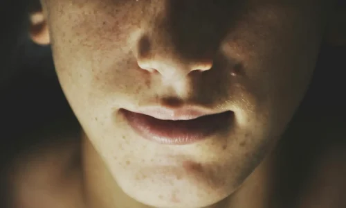 Mestrado em Cosmética para Hiperpigmentação e Melasma 1