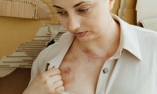 Mestrado em Avaliação de Segurança Cosmética e Dermatite por Cosméticos 3