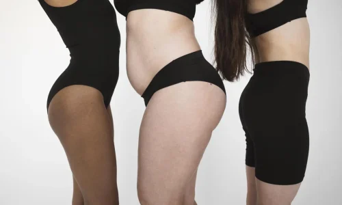 MESTRADO EM LIPOTRANSFERÊNCIA E GLUTEOPLASTIA 1