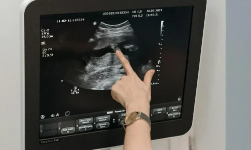 Mestrado em Obstetrícia Fundamental 1