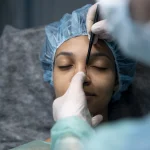 Mestrado em Rinoplastia Avançada Funcional e Estética 1