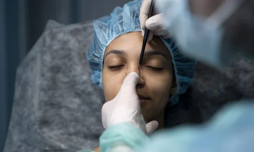 Mestrado em Rinoplastia Avançada Funcional e Estética 1