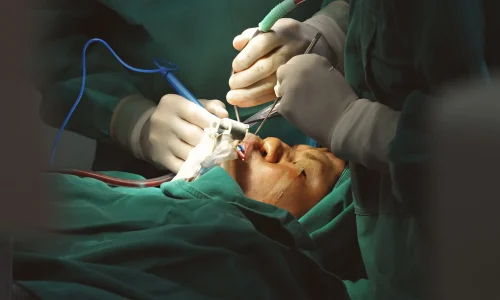 Mestrado em Suporte em Cirurgia Facial para Técnicos em Enfermagem 1