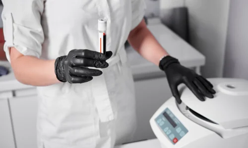 Mestrado em Terapias Regenerativas Íntimas: PRP e Bioestimulação 1