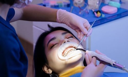 odontologia-estetica-iseie-diplomado