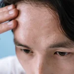 Mestrado em Medicina Estética em Peles com Doença Dermatológica e Segurança 1