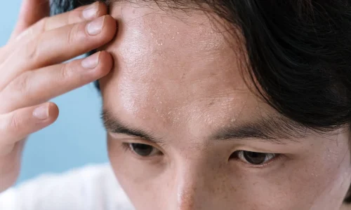 Mestrado em Medicina Estética em Peles com Doença Dermatológica e Segurança 1