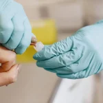 Mestrado em Patologia, Estética e Reconstrução das Unhas 1