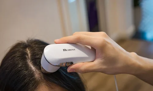 Mestrado em Patologia do Cabelo e Couro Cabeludo: Dermato-Tricologia 1