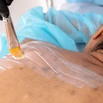 Mestrado em Peelings Médicos e Tratamentos Médicos Tópicos e Sistêmicos 1