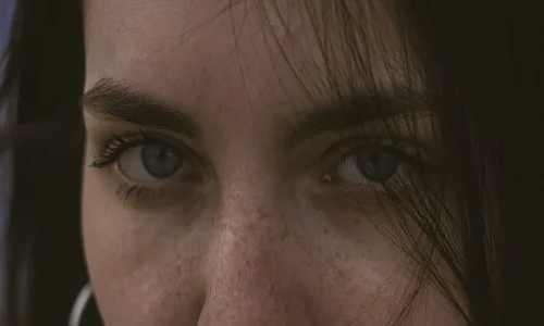 Mestrado em Dermatoestética em Fototipos Altos, Riscos e Protocolos 3