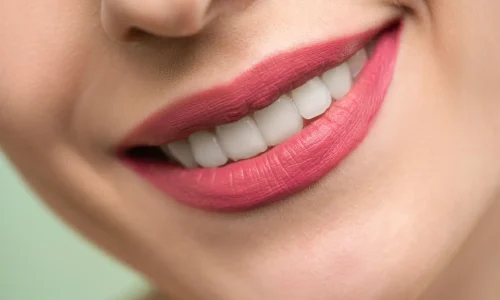 Mestrado em Estética Digital e Design de Sorriso 1